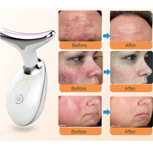 Lustre™ LED Facial Device